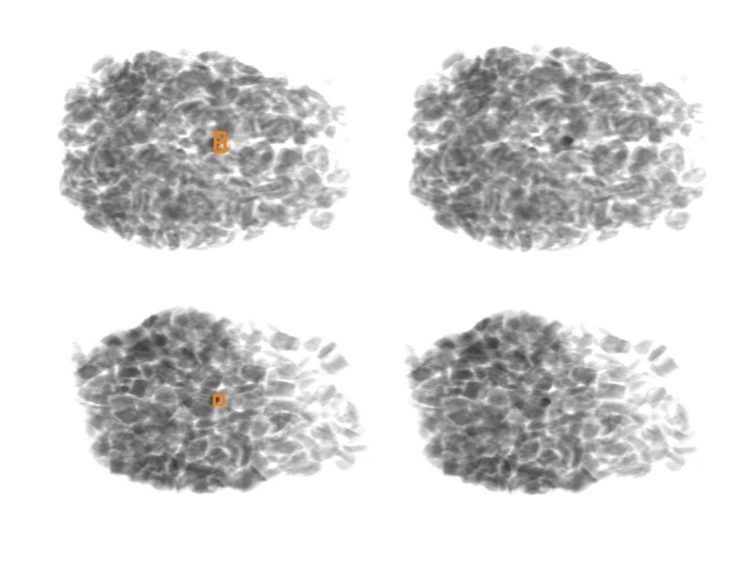 Stone detection in food using X-ray technology